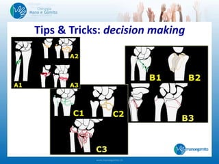 Tips & Tricks: decision making
 