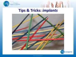 Tips & Tricks: implants
 