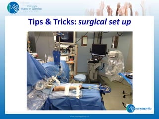 Tips & Tricks: surgical set up
 