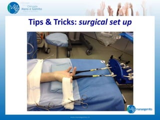 Tips & Tricks: surgical set up
 