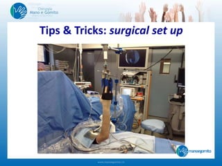 Tips & Tricks: surgical set up
 