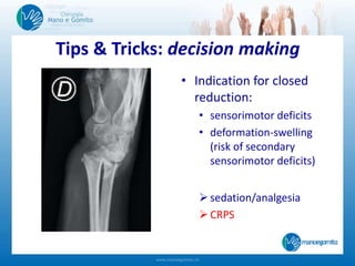 • Indication for closed
reduction:
• sensorimotor deficits
• deformation-swelling
(risk of secondary
sensorimotor deficits)
sedation/analgesia
CRPS
Tips & Tricks: decision making
 