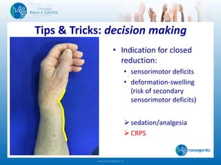 • Indication for closed
reduction:
• sensorimotor deficits
• deformation-swelling
(risk of secondary
sensorimotor deficits)
sedation/analgesia
CRPS
Tips & Tricks: decision making
 