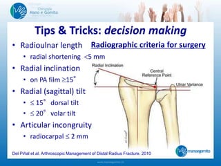 • Radioulnar length
• radial shortening 5 mm
• Radial inclination
• on PA film 15°
• Radial (sagittal) tilt
•  15°dorsal tilt
•  20°volar tilt
• Articular incongruity
• radiocarpal  2 mm
Radiographic criteria for surgery
Del Piñal et al. Arthroscopic Management of Distal Radius Fracture. 2010
Tips & Tricks: decision making
 