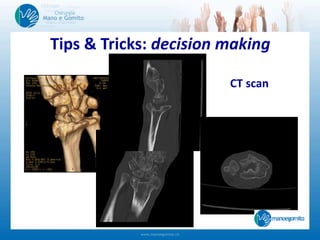 Tips & Tricks: decision making
CT scan
 