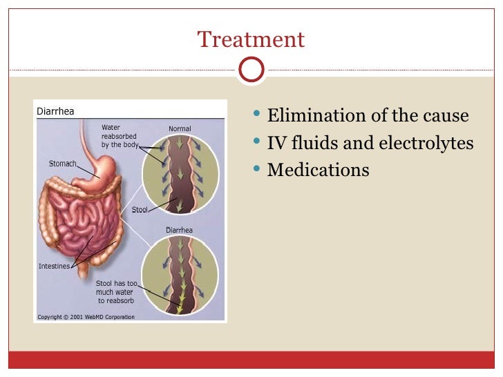 IBS, Constipation & Diarrhea