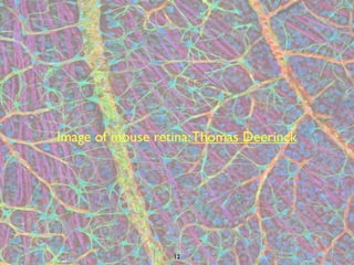 Image of mouse retina: Thomas Deerinck




                  12
 