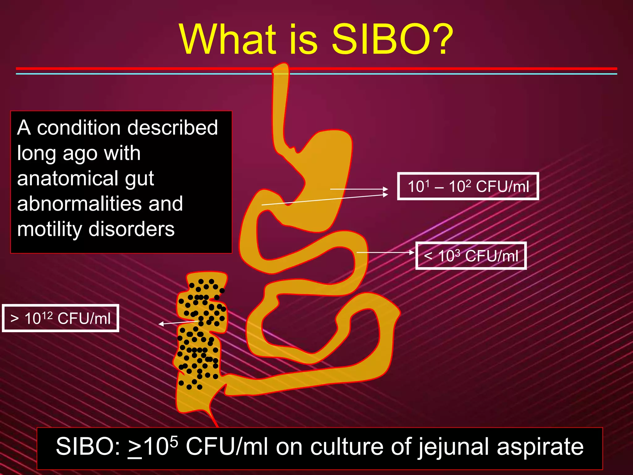 25
101 – 102 CFU/ml
< 103 CFU/ml
> 1012 CFU/ml
What is SIBO?
SIBO: >105 CFU/ml on culture of jejunal aspirate
A condition described
long ago with
anatomical gut
abnormalities and
motility disorders
 