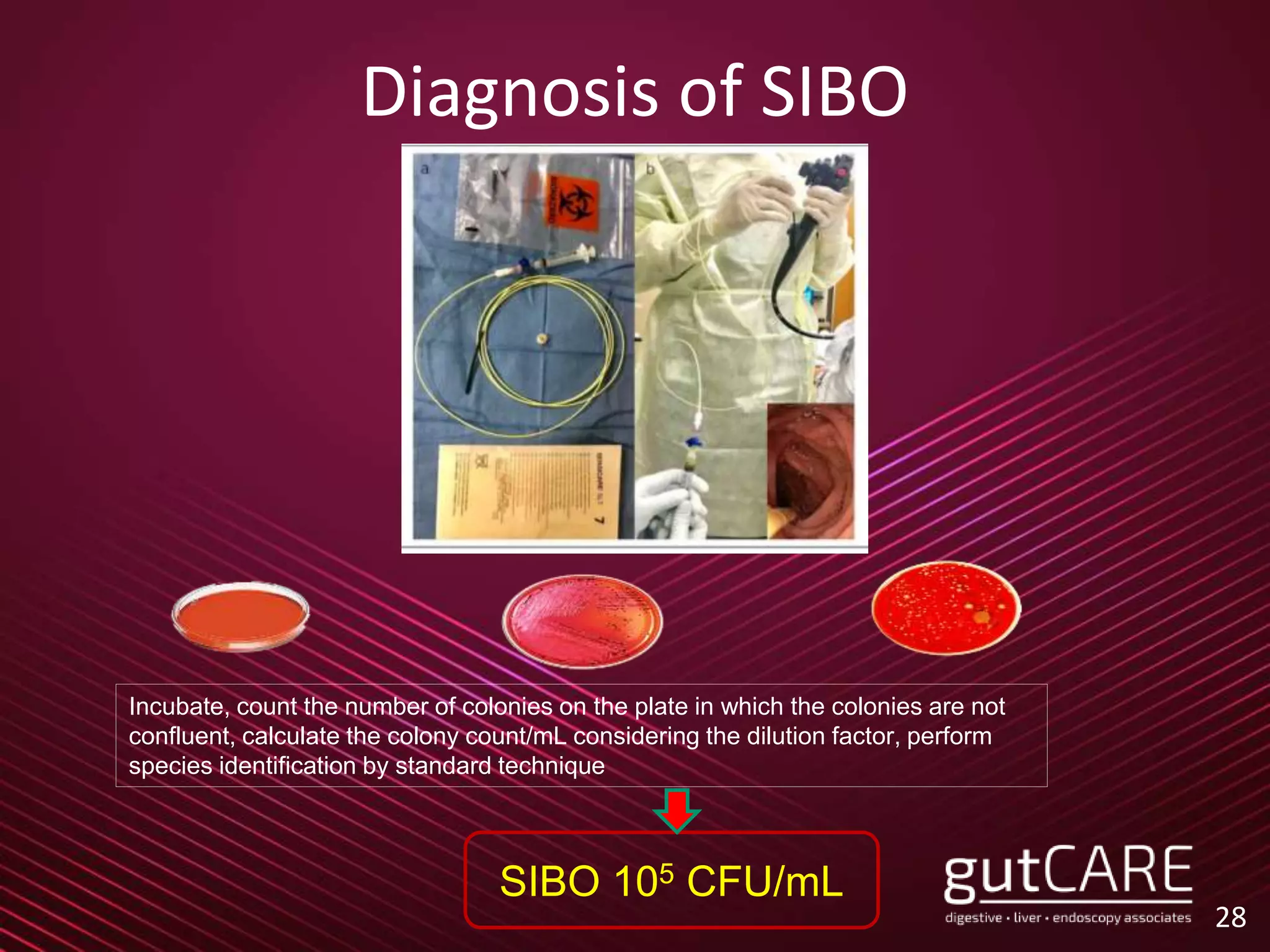 Diagnosis of SIBO
28
SIBO 105 CFU/mL
Incubate, count the number of colonies on the plate in which the colonies are not
confluent, calculate the colony count/mL considering the dilution factor, perform
species identification by standard technique
 