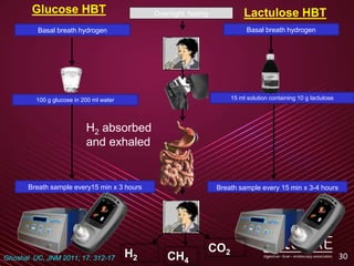 30
Glucose HBT Lactulose HBTOvernight fasting
Breath sample every15 min x 3 hours Breath sample every 15 min x 3-4 hours
100 g glucose in 200 ml water 15 ml solution containing 10 g lactulose
Basal breath hydrogen Basal breath hydrogen
H2 CH4
CO2
H2 absorbed
and exhaled
Ghoshal UC, JNM 2011; 17: 312-17
 