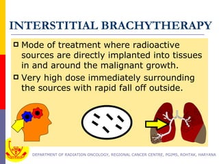 Interstitial Radiotherapy physics and clinical aspects of interstitial brachytherapy | PPT
