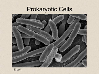 Prokaryotic Cells E. coli 