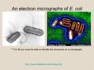 An electron micrographs of  E. coli ** For IB you must be able to identify the structures on a micrograph. http:// www.cellsalive.com/index.htm 