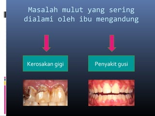 Ibu Mengandung Dan Kesihatan Pergigian