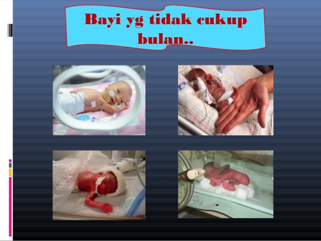 Ibu mengandung dan kesihatan pergigian