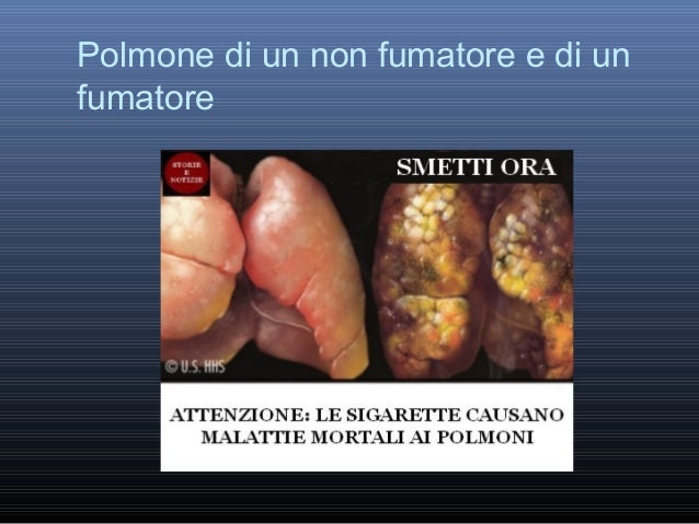 Come meglio smetterà di fumare subito o gradualmente