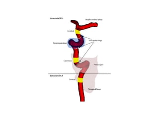 Ica Angulation ICA anatomy | PPTX