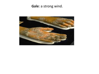 Gale: a strong wind.
 