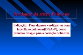 Bandagem da artéria PulmonarBandagem da artéria Pulmonar
Indicação: Para algumas cardiopatias comIndicação: Para algumas cardiopatias com
hiperfluxo pulmonar(D SA-V), comohiperfluxo pulmonar(D SA-V), como
primeiro estagio para a correção definitivaprimeiro estagio para a correção definitiva
 