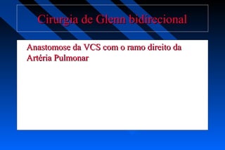 Cirurgia de Glenn bidirecionalCirurgia de Glenn bidirecional
Anastomose da VCS com o ramo direito daAnastomose da VCS com o ramo direito da
Artéria PulmonarArtéria Pulmonar
 