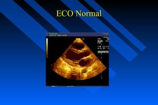 ECO NormalECO Normal
 