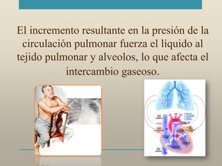 El incremento resultante en la presión de la
circulación pulmonar fuerza el líquido al
tejido pulmonar y alveolos, lo que afecta el
intercambio gaseoso.
 