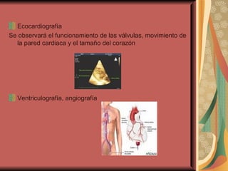 Ecocardiografía Se observará el funcionamiento de las válvulas, movimiento de la pared cardiaca y el tamaño del corazón Ventriculografía, angiografía 