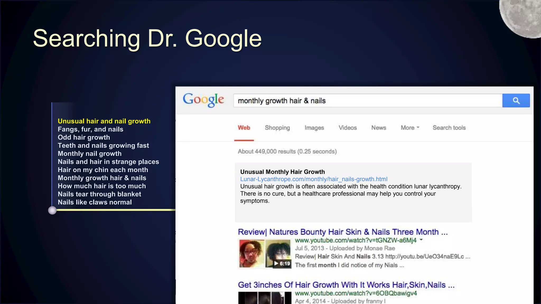 Searching Dr. Google
ACTIVE
SOLUTION
CONSIDER
Unusual hair and nail growth
Fangs, fur, and nails
Odd hair growth
Teeth and nails growing fast
Monthly nail growth
Nails and hair in strange places
Hair on my chin each month
Monthly growth hair & nails
How much hair is too much
Nails tear through blanket
Nails like claws normal
Unusual Monthly Hair Growth
Lunar-Lycanthrope.com/monthly/hair_nails-growth.html
Unusual hair growth is often associated with the health condition lunar lycanthropy.
There is no cure, but a healthcare professional may help you control your
symptoms.
M
 