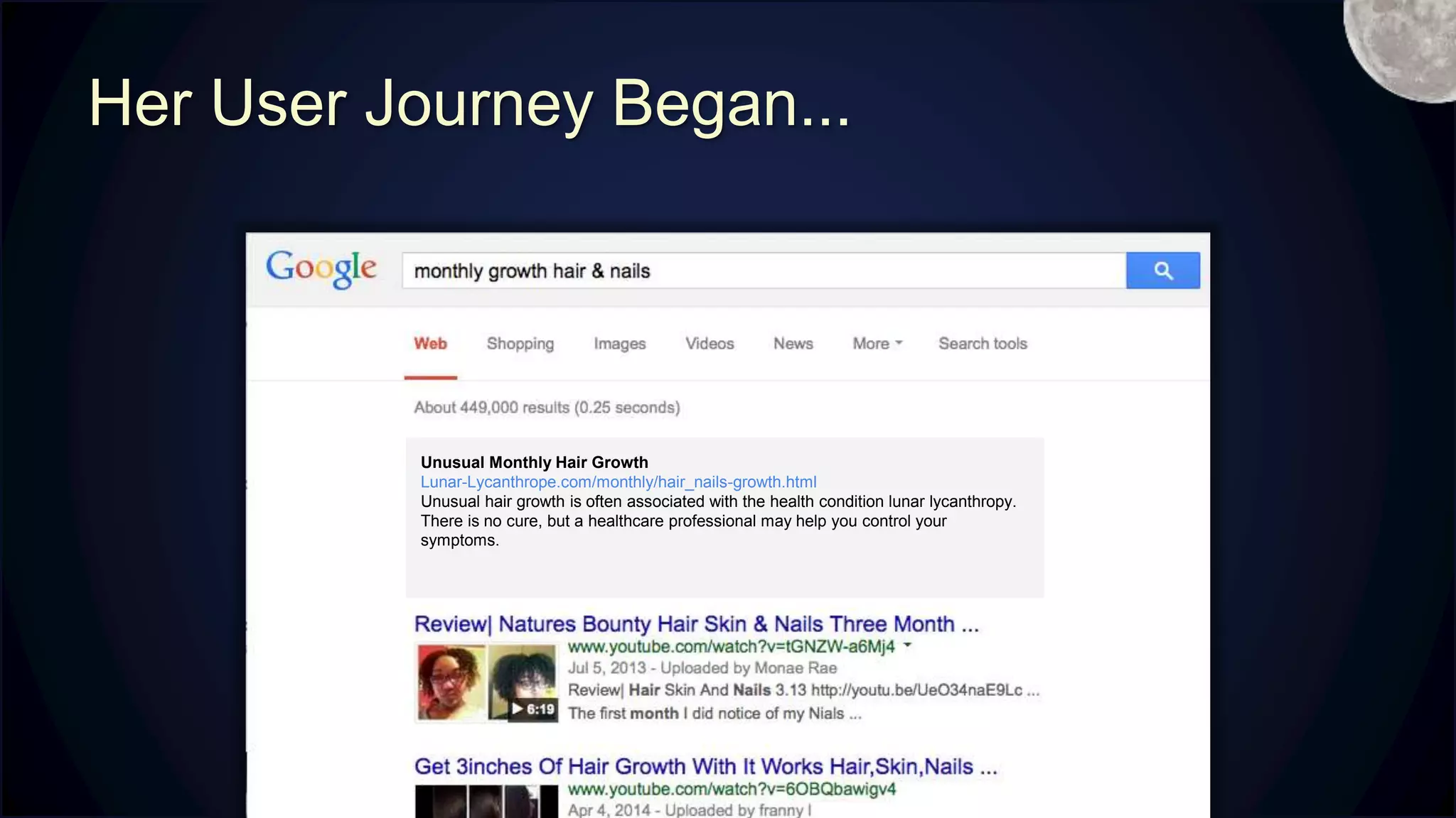 Her User Journey Began...
Unusual Monthly Hair Growth
Lunar-Lycanthrope.com/monthly/hair_nails-growth.html
Unusual hair growth is often associated with the health condition lunar lycanthropy.
There is no cure, but a healthcare professional may help you control your
symptoms.
M
 