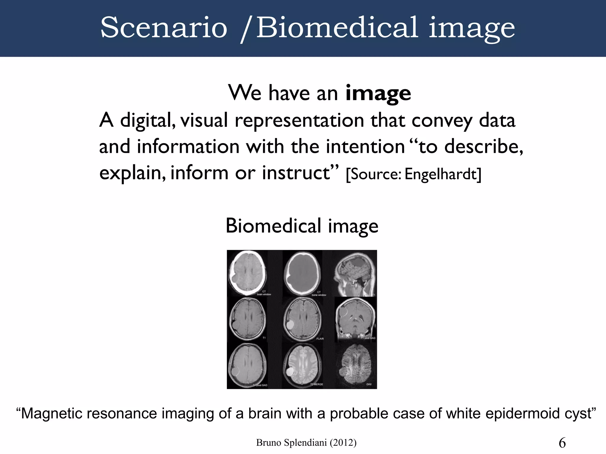 Scenario /Biomedical image

                               We have an image
            A digital, visual representation that convey data
            and information with the intention “to describe,
            explain, inform or instruct” [Source: Engelhardt]

                              Biomedical image




“Magnetic resonance imaging of a brain with a probable case of white epidermoid cyst”
                                   Bruno Splendiani (2012)                     6
 
