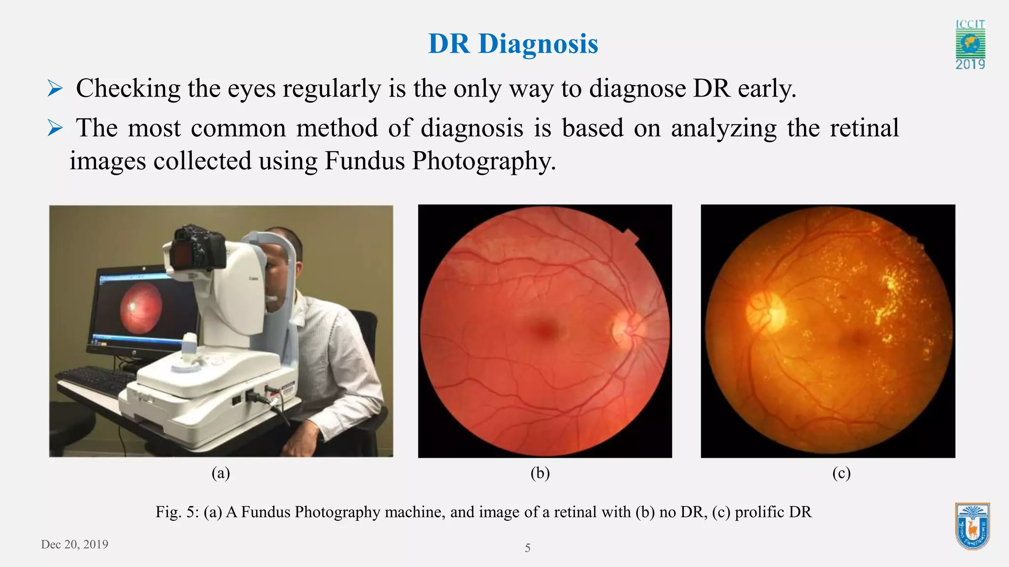 5
DR Diagnosis
Fig. 5: (a) A Fundus Photography machine, and image of a retinal with (b) no DR, (c) prolific DR
 Checking the eyes regularly is the only way to diagnose DR early.
 The most common method of diagnosis is based on analyzing the retinal
images collected using Fundus Photography.
(a) (b) (c)
Dec 20, 2019
 
