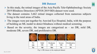 Dec 20, 2019
7
DR Dataset
Fig. 6: DR classes in the employed dataset
 In this study, the retinal images of the Asia Pacific Tele-Ophthalmology Society
2019 Blindness Detection (APTOS 2019 BD) dataset were used.
 The dataset contains 3,662 retinal images collected from numerous subjects
living in the rural areas of India.
 The images were put together by Aravind Eye Hospital, India, with the purpose
of building an ML model to detect blindness without medical screening.
 Based on the severity, the images are categorized as – no DR, mild DR,
moderate DR, severe DR, and proliferative DR.
 