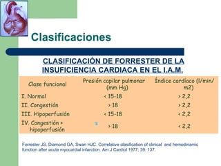 Diamond Forrester Plot Insuficiencia Cardiaca | PPT