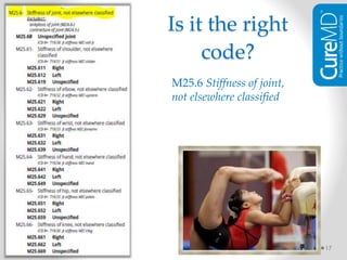 17
M25.6 Stiffness of joint,
not elsewhere classified
Is it the right
code?
 