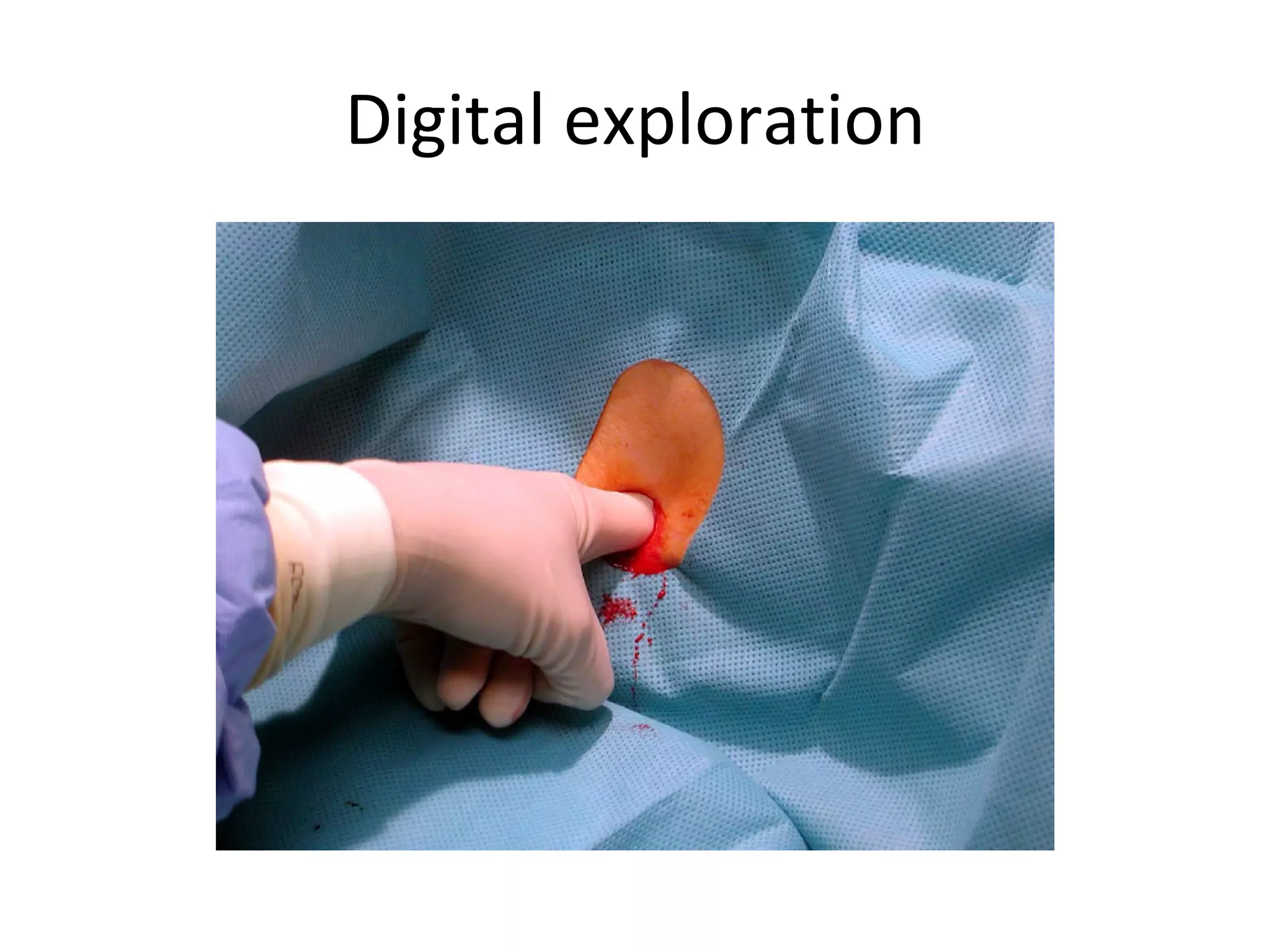 Digital exploration 