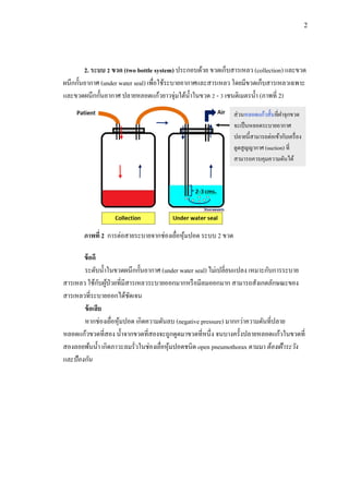 2
2. ระบบ 2 ขวด (two bottle system) ประกอบด้วย ขวดเก็บสารเหลว (collection) และขวด
ผนึกกั้นอากาศ (under water seal) เพื่อใช้ระบายอากาศและสารเหลว โดยมีขวดเก็บสารเหลวเฉพาะ
และขวดผนึกกั้นอากาศ ปลายหลอดแก้วยาวจุ่มใต้น้าในขวด 2 - 3 เซนติเมตรน้า (ภาพที่ 2)
ข้อดี
ระดับน้าในขวดผนึกกั้นอากาศ (under water seal) ไม่เปลี่ยนแปลง เหมาะกับการระบาย
สารเหลว ใช้กับผู้ป่วยที่มีสารเหลวระบายออกมากหรือมีลมออกมาก สามารถสังเกตลักษณะของ
สารเหลวที่ระบายออกได้ชัดเจน
ข้อเสีย
หากช่องเยื่อหุ้มปอด เกิดความดันลบ (negative pressure) มากกว่าความดันที่ปลาย
หลอดแก้วขวดที่สอง น้าจากขวดที่สองจะถูกดูดมาขวดที่หนึ่ง จนบางครั้งปลายหลอดแก้วในขวดที่
สองลอยพ้นน้า เกิดภาวะลมรั่วในช่องเยื่อหุ้มปอดชนิด open pneumothorax ตามมา ต้องเฝ้าระวัง
และป้องกัน
ภาพที่ 2 การต่อสายระบายจากช่องเยื่อหุ้มปอด ระบบ 2 ขวด
ส่วนหลอดแก้วสั้นที่ฝาจุกขวด
จะเป็นหลอดระบายอากาศ
ปลายนี้สามารถต่อเข้ากับเครื่อง
ดูดสูญญากาศ (suction) ที่
สามารถควบคุมความดันได้
 