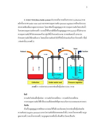 3
3. ระบบ 3 ขวด (three bottle system) ประกอบด้วย ขวดเก็บสารเหลว (collection) ขวด
ผนึกกั้นอากาศ (under water seal) และขวดควบคุมความดัน (pressure regulator) เหมือนกับระบบ
สองขวดเพียงเพิ่มแรงดูดจากภายนอก โดยอาศัยเครื่องดูดสุญญากาศ ควบคุมความดันโดยระดับน้า
ในขวดควบคุมความดันขวดที่ 3 ระบบนี้ใช้ในกรณีที่มีเครื่องดูดสูญญากาศ (suction) ที่ไม่สามารถ
ควบคุมความดันได้ปลายหลอดแก้วยาวจุ่มใต้น้าในขวดประมาณ 10 เซนติเมตรน้า (สามารถ
กาหนดความดันได้ตามต้องการ โดยจะตั้งความดันเท่าใดให้ใส่น้าท่วมแท่งแก้วยาวในขวดที่ 3 ซึ่งมี
3 ท่อเท่านั้น) (ภาพที่ 3)
ข้อดี
ความดันในช่องเยื่อหุ้มปอด = ความดันในขวดที่สอง + ความดันในขวดที่สาม
การควบคุมความดันได้ดี เป็นระบบที่ปลอดภัยที่สุด เหมาะกับการระบายลมและสารเหลว
ข้อเสีย
ถ้าเครื่องดูดสูญญากาศเสียจะระบายลมได้ไม่ดี และยังคงพบว่าหากช่องเยื่อหุ้มปอดเกิด
ความดันลบ (negative pressure) มากกว่าความดันที่ปลายหลอดแก้วทั้ง 2 ขวด น้าจากขวดที่3 จะถูก
ดูดมาขวดที่ 2 และน้าจากขวดที่ 2 จะถูกดูดมาขวดที่หนึ่ง ต้องเฝ้าระวังและป้องกัน
ภาพที่ 3 การต่อสายระบายจากช่องเยื่อหุ้มปอด ระบบ 3 ขวด
 