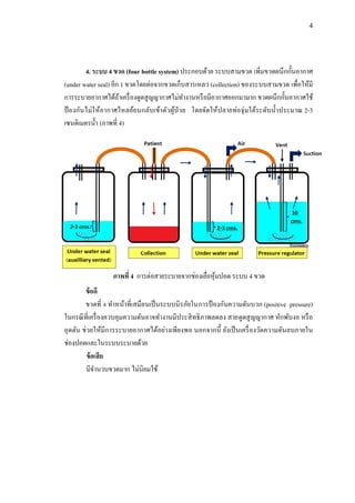 4
4. ระบบ 4 ขวด (four bottle system) ประกอบด้วย ระบบสามขวด เพิ่มขวดผนึกกั้นอากาศ
(under water seal) อีก 1 ขวดโดยต่อจากขวดเก็บสารเหลว (collection) ของระบบสามขวด เพื่อให้มี
การระบายอากาศได้ถ้าเครื่องดูดสูญญากาศไม่ทางานหรือมีอากาศออกมามาก ขวดผนึกกั้นอากาศใช้
ป้ องกันไม่ให้อากาศไหลย้อนกลับเข้าตัวผู้ป่วย โดยจัดให้ปลายท่อจุ่มใต้ระดับน้าประมาณ 2-3
เซนติเมตรน้า (ภาพที่ 4)
ข้อดี
ขวดที่ 4 ทาหน้าที่เสมือนเป็นระบบนิรภัยในการป้ องกันความดันบวก (positive pressure)
ในกรณีที่เครื่องควบคุมความดันอาจทางานมีประสิทธิภาพลดลง สายดูดสูญญากาศ หักพับงอ หรือ
อุดตัน ช่วยให้มีการระบายอากาศได้อย่างเพียงพอ นอกจากนี้ ยังเป็นเครื่องวัดความดันลบภายใน
ช่องปอดและในระบบระบายด้วย
ข้อเสีย
มีจานวนขวดมาก ไม่นิยมใช้
ภาพที่ 4 การต่อสายระบายจากช่องเยื่อหุ้มปอด ระบบ 4 ขวด
 