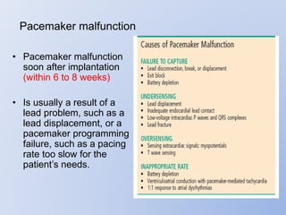 • Pacemaker malfunction
soon after implantation
(within 6 to 8 weeks)
• Is usually a result of a
lead problem, such as a
lead displacement, or a
pacemaker programming
failure, such as a pacing
rate too slow for the
patient’s needs.
Pacemaker malfunction
 
