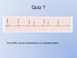 Quiz ?
“end-of-life” pacing characteristics of a depleted battery
 