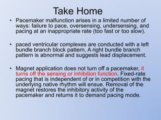 Take Home
• Pacemaker malfunction arises in a limited number of
ways: failure to pace, oversensing, undersensing, and
pacing at an inappropriate rate (too fast or too slow).
• paced ventricular complexes are conducted with a left
bundle branch block pattern, A right bundle branch
pattern is abnormal and suggests lead displacement.
• Magnet application does not turn off a pacemaker, it
turns off the sensing or inhibition function. Fixed-rate
pacing that is independent of or in competition with the
underlying native rhythm will ensue. Removal of the
magnet restores the inhibitory activity of the
pacemaker and returns it to demand pacing mode.
 
