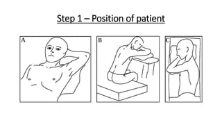 Step 1 – Position of patient
 
