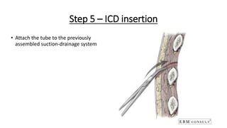 Step 5 – ICD insertion
• Attach the tube to the previously
assembled suction-drainage system
 