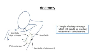 Anatomy
• Triangle of safety – through
which ICD should be inserted
with minimal complications.
 