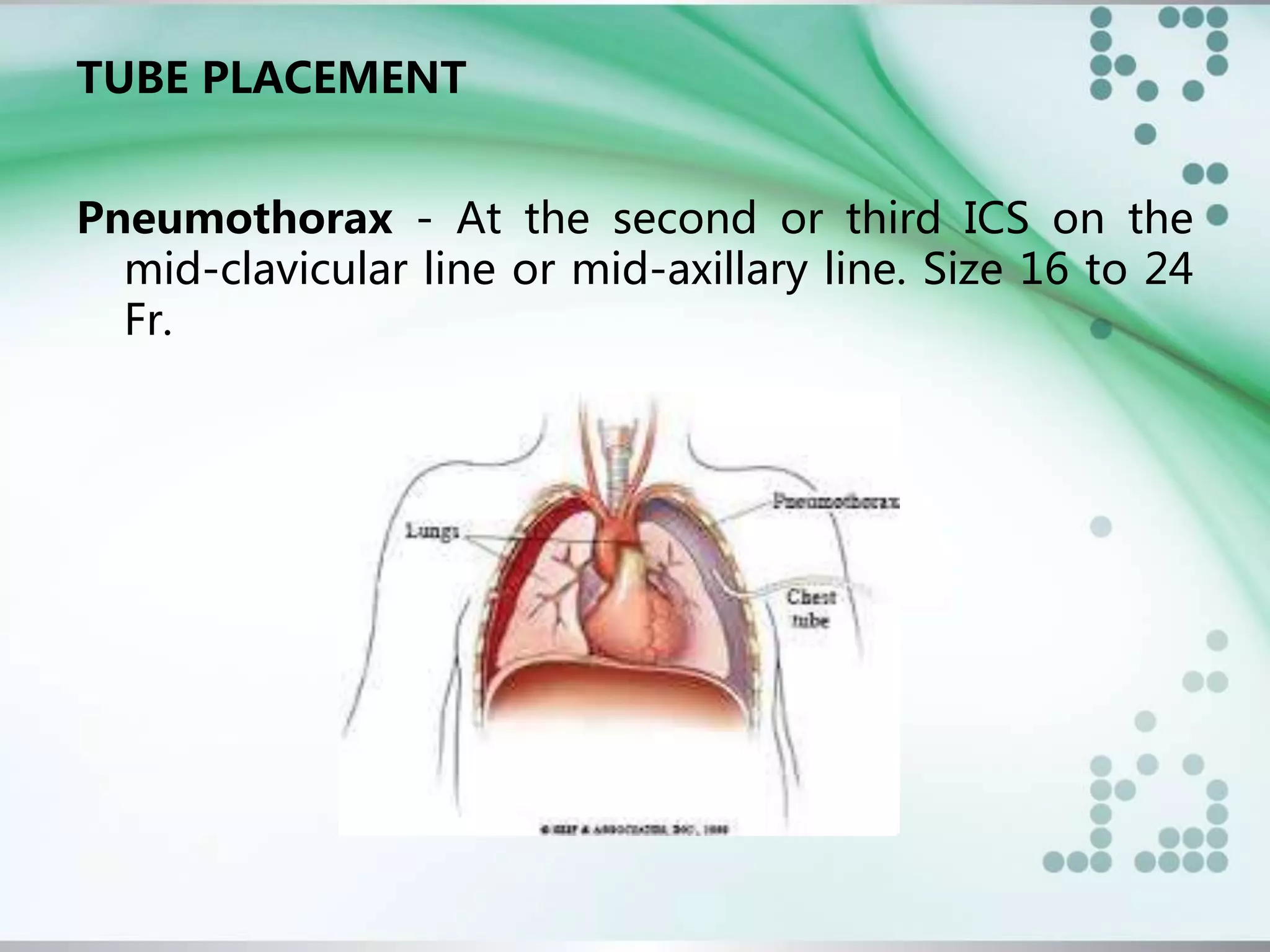 CHEST TUBE DRAINAGE | PPTX