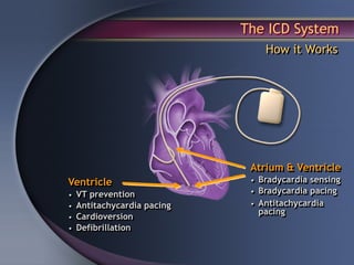 The ICD System
                                 How it Works




                              Atrium & Ventricle
Ventricle                     • Bradycardia sensing
•   VT prevention             • Bradycardia pacing
•   Antitachycardia pacing    • Antitachycardia
                               pacing
•   Cardioversion
•   Defibrillation
 