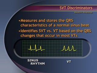 SVT Discriminators
                              Waveform Morphology




•Measures and stores the QRS
 characteristics of a normal sinus beat
•Identifies SVT vs. VT based on the QRS
 changes that occur in most VTs




    SINUS                VT
      RHYTHM
 