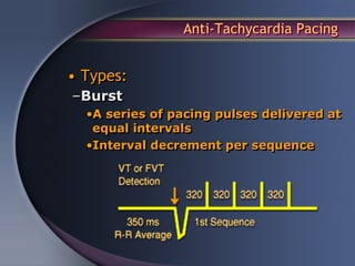 Anti-Tachycardia Pacing


• Types:
–Burst
  •A series of pacing pulses delivered at
   equal intervals
  •Interval decrement per sequence
 