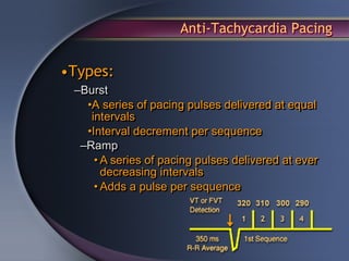 Anti-Tachycardia Pacing


•Types:
 –Burst
   •A series of pacing pulses delivered at equal
    intervals
   •Interval decrement per sequence
  –Ramp
     • A series of pacing pulses delivered at ever
       decreasing intervals
     • Adds a pulse per sequence
 