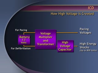 ICD
                             How High Voltage Is Created



   For Pacing                                  Pacing
                       Voltage                 Voltages
       Battery        Multiplier
          3.2            and
         Volts                       High      High Energy
                     Transformer
                                    Voltage    Shocks
For Defibrillation
                                   Capacitor   (Up to 800 Volts)
 